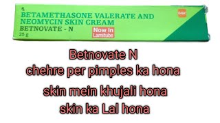 betnovate N cream skin mein khujali ka hona chehre per pimple ka hona skin ka Lal hona [upl. by Arret]