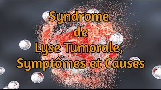 Syndrome de lyse tumorale symptômes et causes [upl. by Fricke144]