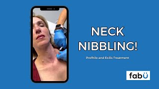 Profhilo and Exilis Treatment A Comprehensive Guide to a Rejuvenated Neck NonSurgicalLift [upl. by Elfie872]