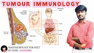 Tumour immunology  Class 12  Neet Biology MAGESHBIOLOGY [upl. by Corilla]