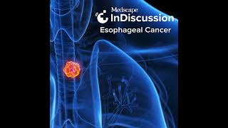 Understanding Detecting and Treating Gastroesophageal Junction Adenocarcinoma [upl. by Persons]