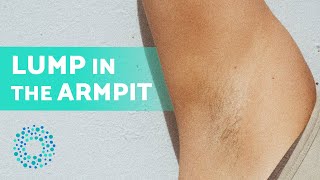 PAINFUL LUMP Under the ARM 6 Causes 💥 Painful Armpit Lump [upl. by Bean]