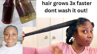 This Will Speed Up Your Stunted Hair Growth Only 2 Ingredients For Overnight Hair Growth [upl. by Ingham358]