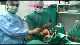 DBS Surgery for Parkinsons disease  DrParesh K Doshi [upl. by Sone332]