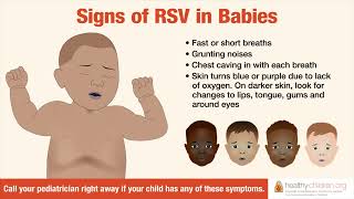 Signs amp Symptoms of RSV in Babies  AAP [upl. by Schear]