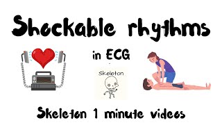 Shockable rhythms in ECG in 1 min  Skeleton ACLS shorts [upl. by Eirolam779]