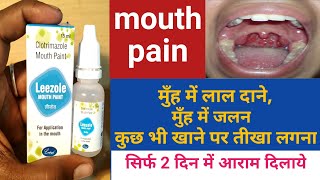 Mouth paint  मुँह में होने वाली हर पीड़ा से छुटकारा। [upl. by Creedon]