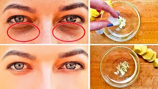 How to Get Rid of Black Circles Under Your Eyes [upl. by Arlette645]