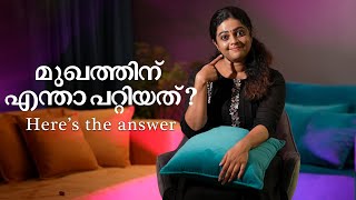 മുഖത്തിന് എന്താ പറ്റിയത് Here’s the answer  Aswathy Sreekanth  Life Unedited aswathysreekanth [upl. by Eleanora]