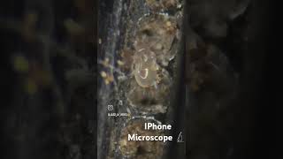 IPhone Microscope 🔬2024ipl iphoneinstagram microscopetiktokyoutube ytshortyoutubeshorts [upl. by Yendic]