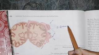 Functional localization of Cerebrum temporal lobe areas part3 neuroanatomy [upl. by Kallista755]