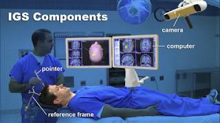 Image Guided Surgery for Brain Tumors [upl. by Eahc77]