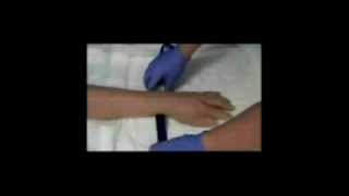 IV Cannulation Techniqueflv [upl. by Radu]