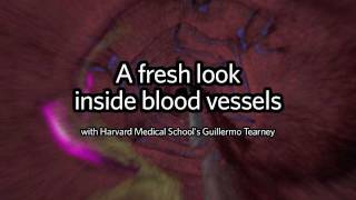 A fresh look inside blood vessels [upl. by Nnauol]