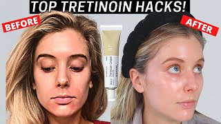 Top Tretinoin Tips How to Use Tretinoin Without Irritation  Tretinoin Mistakes [upl. by Mehala673]