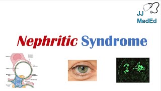 Nephritic Syndrome  Clinical Presentation Causes and Treatment [upl. by Diannne]