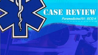 Paramedicine101 ECG Case 4 [upl. by Palocz792]