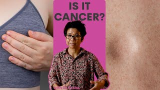 Are All Breast Lumps Cancer With Dr Tasha [upl. by Barcroft]