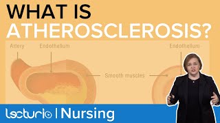 Pathophysiology of Atherosclerosis How does the Plaque Form  Pathophysiology  Lecturio Nursing [upl. by Younglove]