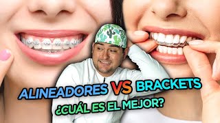 BRACKETS VS ALINEADORES DENTALES en 2022  ¿ORTODONCIA INVISIBLE O TRADICIONAL 🔥 [upl. by Ula]