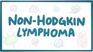 Nonhodgkin lymphoma  causes symptoms diagnosis treatment pathology [upl. by Ardnasella]