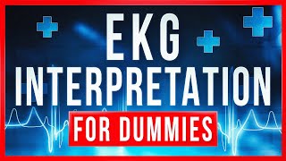 EKG Interpretation for DUMMIES [upl. by Donica]