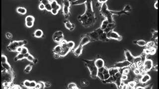 MCF7 cells cultured in M04O microfluidic plate [upl. by Sirromaj]