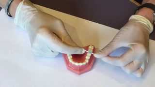 How to replace your orthodontic separators aka spacers at home [upl. by Mook]