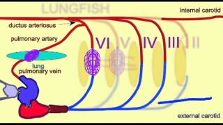 CVA3AORTIC ARCHESFROGavi [upl. by Assillim]