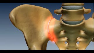 Where is the Sacroiliac Joint Anatomy of the Sacroiliac Joint [upl. by Doreen]