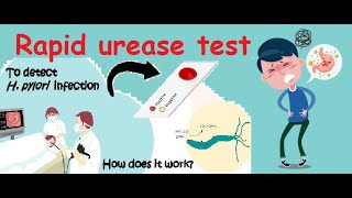 Urease Test  Microbiology  urease bacteria biochemical [upl. by Torie]