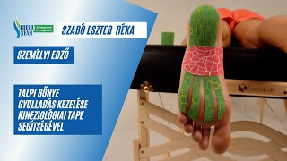 Kinesio tape technikák – Plantar fasciitis talpi bőnye gyulladás kezelése kinesiotape theraband [upl. by Arvell]