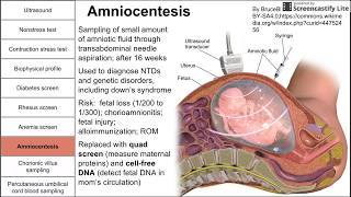 Prenatal screening fetal testing and other tests during pregnancy [upl. by Eberly]