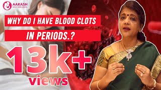 Are blood clots normal during a period [upl. by Atirec]