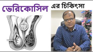 ভেরিকোসিল এর চিকিৎসা  Treatment of varicocele in Bangla [upl. by Tuckie929]