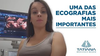 Ecografia gestacional morfológica do 2° Trimestre   Tatiana Coury [upl. by Ardnuek]