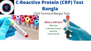 সি আর পি টেস্ট কি CRP C Reactive Protein Test Bangla  CRP Blood Test Procedure Bangla Tech [upl. by Bruno]