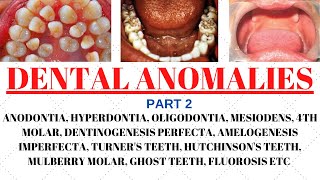 What causes abnormal eruption of teeth  Dr Ratra Orthodontist and Implantologist  Expert Advise [upl. by Notlil]