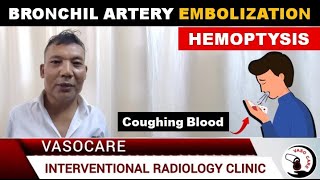 BRONCHIL ARTERY EMBOLIZATION  BAE  for Coughing Blood  Hemoptysis  Arup Karmakar MDDNB [upl. by Cole]