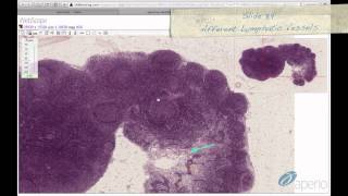 Histology Helper  Lymphoid Tissue Histology [upl. by Aleksandr556]