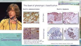 Gastric carcinogenesis of gastric cancer through the eyes of a pathologist [upl. by Tselec193]