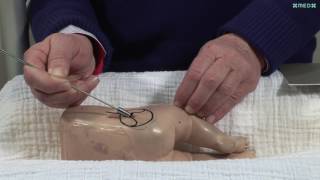 Baby Hip Ultrasound Graf method with Professor Dr Reinhard Graf [upl. by Lottie]