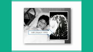 Perspectives on Aphasia Communication Breakdowns in Medical Settings [upl. by Neelhtac]