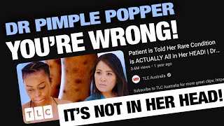 Calling Out Dr Pimple Popper  Mysterious Rash Prurigo Nodularis [upl. by Rodmann]