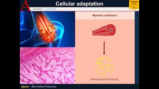 Cellular Pathology  Metaplasia [upl. by Prager]