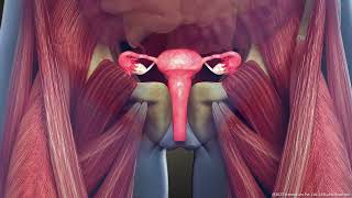 What is Intramural Uterine Fibroid Symptoms and Treatment  3D Guide [upl. by Aihsar]