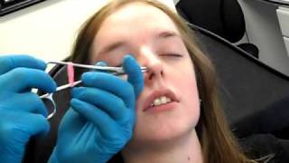 Double Nostril Piercing 2 in 1 sitting [upl. by Turmel939]