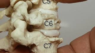 Dynamic Cervical Spinal Stenosis Model  Human Anatomical Disc [upl. by Bosson678]