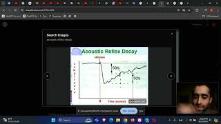 Otolaryngology ENT Audiology Acoustic reflex decay [upl. by Hanny]