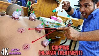 Hijama Treatment For Dead Cells  Cupping Technique By Asim  Neck Cracking  ASMR 4K [upl. by Agostino]